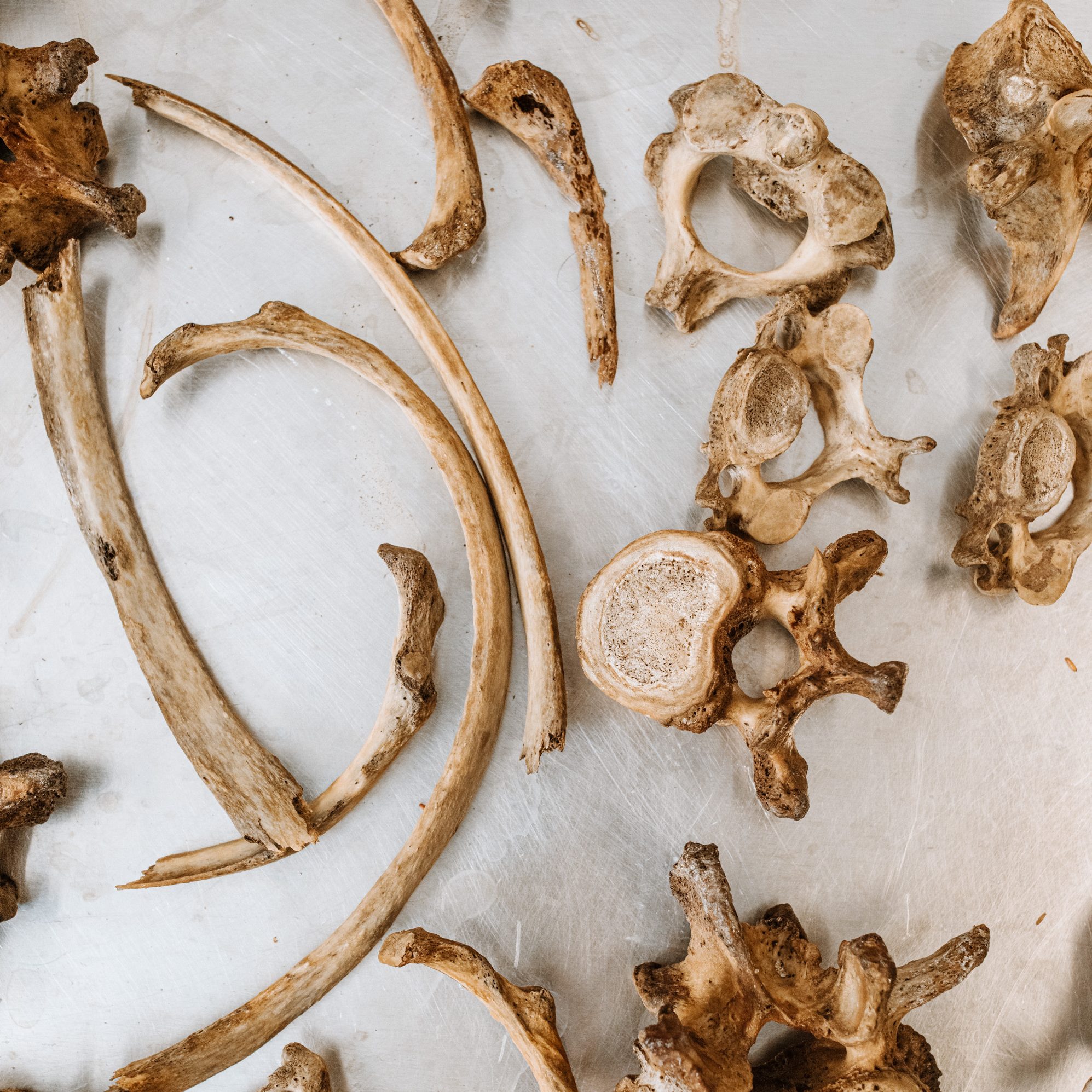 overhead view of bones on a metal tray